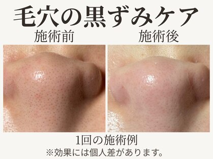 ピュアボーテ(PURE BEAUTE)の写真
