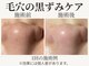 ピュアボーテ(PURE BEAUTE)の写真