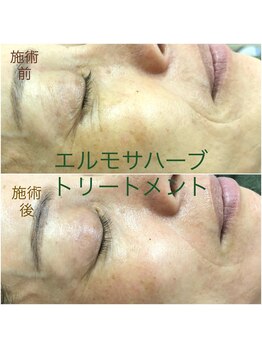 クリアボーテ/エルモサグリーンハーブ