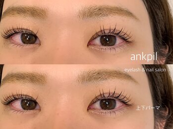 アノカプイル(ankpil)/【まつぱ上下】