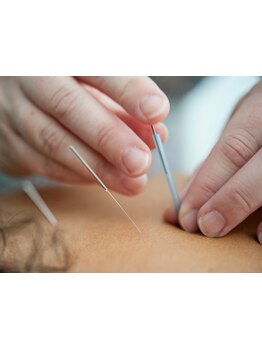 首・肩のつらさを改善したい