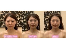 アジール 長岡リバーサイド千秋店(agir)/before/after画像