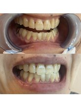 ライトビューティー 池袋店(LightBeauty)/症例写真