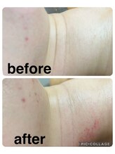 ギンザアール(GINZA R.)/首元ケア♪