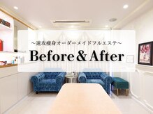 エル 麻布十番(LllL)/痩身/インディバ/ハイパーナイフ