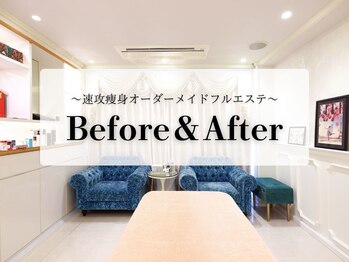 エル 麻布十番(LllL)/痩身/インディバ/ハイパーナイフ