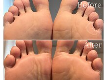 カシェット 広島店(Cachette)/40代男性☆足裏角質ケア60分