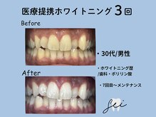 セイ(sei)/症例写真　ビフォーアフター