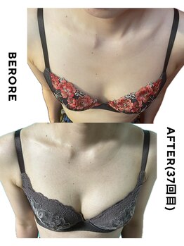 ネイト ワックス(Neit Wax)/バストビフォーアフター◎