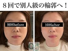 キュープ 鹿児島伊集院店(Qpu)/別人級の輪郭へ導きます！