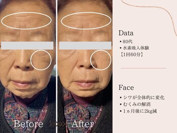 ヨサパーク すずのね(YOSA PARK)/年齢を重ねた方に水素吸入の効果