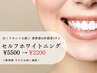 【好感度UP！白くツヤのある歯へ！】セルフホワイトニング　¥2,200