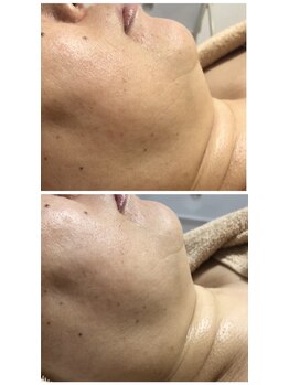 ソルツーサロン マナ(MANA)/フェイスラインで小顔印象UP