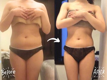 バーリブール 恵比寿店(BERLIBUR)/before/after