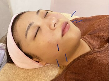 ほほあげ専門 チークアップラボ