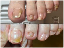 ラグ ネイル(RAG nail)の雰囲気（トラブルネイルもお任せ下さい^_^）