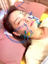 あおなみ はり きゅう整骨院/美容鍼【100本】 顔のお悩み解消