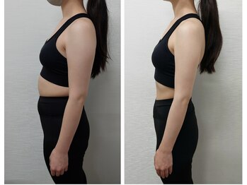 ボディード(BODEAD)/ダイエットプログラム