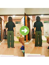 サプライズ整体院/30代ママさんの産後の骨盤初回