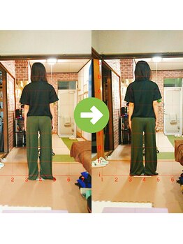 サプライズ整体院/30代ママさんの産後の骨盤初回