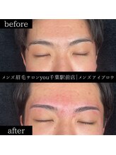 ユー 千葉駅前店(you)/ビフォ－アフター写真