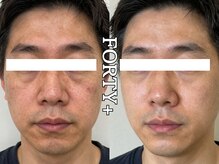 フォーティープラス(FORTY+)/施術事例