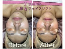 シストワ(sistoi)/★高周波de小顔デザイン★