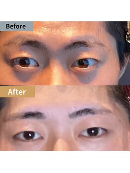 眉毛ハウス 吉祥寺店(眉毛HOUSE)/お客様の施術例(吉祥寺/東京)