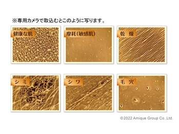 リヴレ(LIVRER)/肌診断