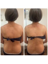 ピンクマジック(PINKMAGIC)/リリースカッター施術ビフォアフ