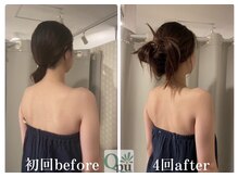 キュープ 福岡天神店(Qpu)/巻肩矯正４回での変化