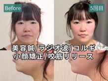 カンワ美容鍼灸院(KANWA美容鍼灸院)