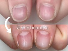 寺子屋ビューティーズ(寺子屋Beauty's)