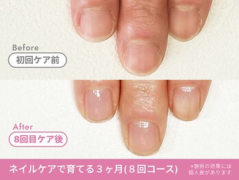 フェリエ(feerie)/Before/After【feerie立川】