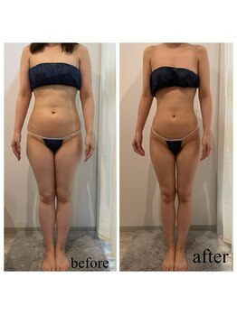 ドリームローズ(Dream Rose)/痩身