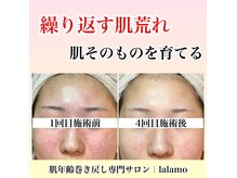 ララモ(lalamo)の雰囲気（ファンデーションで隠す肌ではなく、素肌に自信を持ちたい方に。）