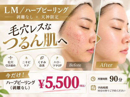 ライム 天神(LIME)の写真