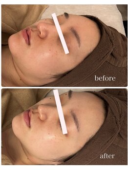 プレジール(Plaisir)/サ-マトリックス+セラピ-ル＆LDM