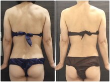 美容整体 ウェリナ 蟹江院/小顔矯正/骨盤矯正/美脚サロン 