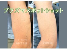 キャスティ(CASTY)