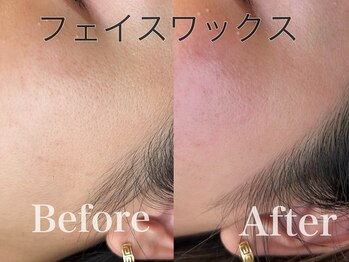 キレイ(Kirei)/産毛、角質も綺麗にとれます♪