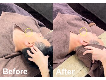 グリズコルギ(Guri's korugi)/コルギ施術効果☆