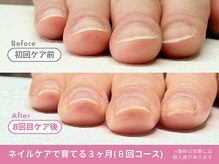 フェリエ(feerie)/Before/After【feerie立川】