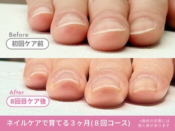 Before/After【feerie立川】