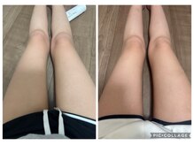 エクラ(Eclat)/Eclatの痩身★before/after18