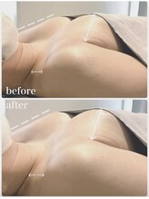 リアン 栄店(Lien)/施術一回目◎Before★After