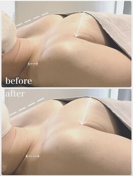 リアン 栄店(Lien)/施術一回目◎Before★After