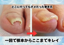巻き爪専門院002 二俣川