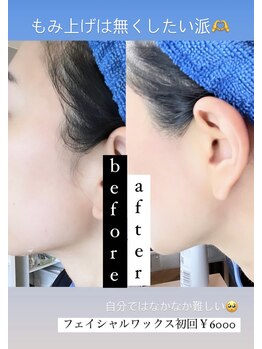 ロア(ROA)/フェイシャルワックス