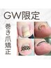 【GW限定メニュー！】爪のお悩み特化　 無料カウンセリング + 矯正体験